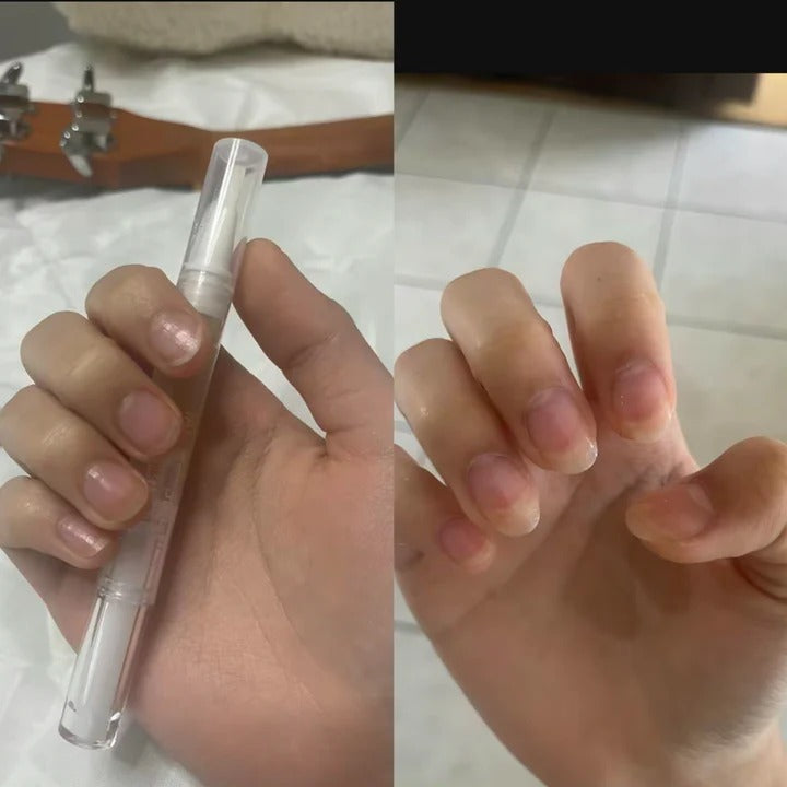 Suero para el crecimiento de las uñas Chic Intime